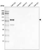Western blot analysis of purified human recombinant Laminin-332, Laminin-421, Laminin-511, Laminin-121 and Laminin-221.