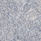 Immunohistochemical staining of human pancreas shows absence of immunoreactivity (negative control).