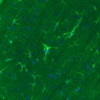 Immunohistochemical staining of rat cerebral cortex shows immunoreactivity in a subset of astrocytes.