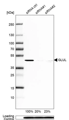 Western blot analysis in HEK293 cells transfected with control siRNA, target specific siRNA probe #1 and #2, using Anti-GLUL antibody. Remaining relative intensity is presented. Loading control: Anti-PPIB.