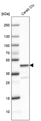 Western blot analysis in human cerebral cortex tissue.