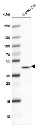 Anti-GLUL Antibody