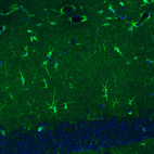 Immunohistochemical staining of mouse dentate gyrus shows immunoreactivity in a subset of astrocytes.