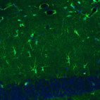 Anti-GLUL Antibody