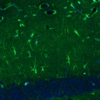 Immunohistochemical staining of mouse dentate gyrus shows immunoreactivity in a subset of astrocytes.
