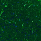 Immunohistochemical staining of rat cerebral cortex shows immunoreactivity in a subset of astrocytes.