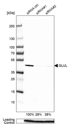 Western blot analysis in HEK293 cells transfected with control siRNA, target specific siRNA probe #1 and #2, using Anti-GLUL antibody. Remaining relative intensity is presented. Loading control: Anti-PPIB.