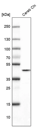 Western blot analysis in human cerebral cortex tissue.