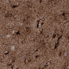 Immunohistochemical staining of human cerebral cortex shows strong immunoreactivity in astrocytes.