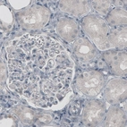 Immunohistochemical staining of human kidney shows absence of immunoreactivity (negative control).