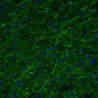 Immunofluorescence staining of mouse brain shows moderate positivity in serotonergic fibers in the basal forebrain.