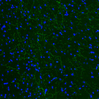 Anti-TPH2 Antibody