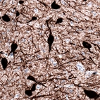 Immunohistochemical staining of human dorsal raphe nucleus shows strong cytoplasmic positivity in serotonin neurons.