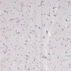 Immunohistochemical staining of human cerebral cortex shows moderate positivity in serotonergic neural fibers.