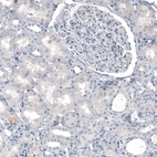 Immunohistochemical staining of human kidney shows no positivity in cells in tubules or glomeruli as expected.