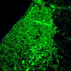 Anti-SLC6A2 Antibody