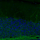 Anti-SLC6A2 Antibody