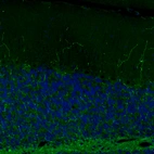Immunofluorescence staining of rat cerebellum shows strong positivity in noradrenergic fibers.