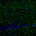 Anti-SLC6A2 Antibody