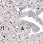 Anti-SLC6A2 Antibody