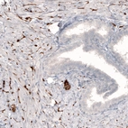 Immunohistochemical staining of human prostate shows strong positivity in sympathetic peripheral nerves.