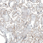 Immunohistochemical staining of human placenta shows weak membranous positivity in trophoblastic cells.