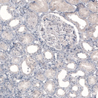 Anti-SLC6A2 Antibody