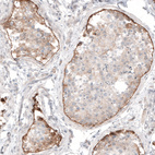 Anti-LAMA1 Antibody