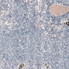 Anti-LAMA1 Antibody