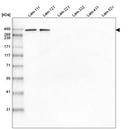 Western blot analysis of purified human recombinant Laminin-111, Laminin-121, Laminin-221, Laminin-332, Laminin-411 and Laminin-521.