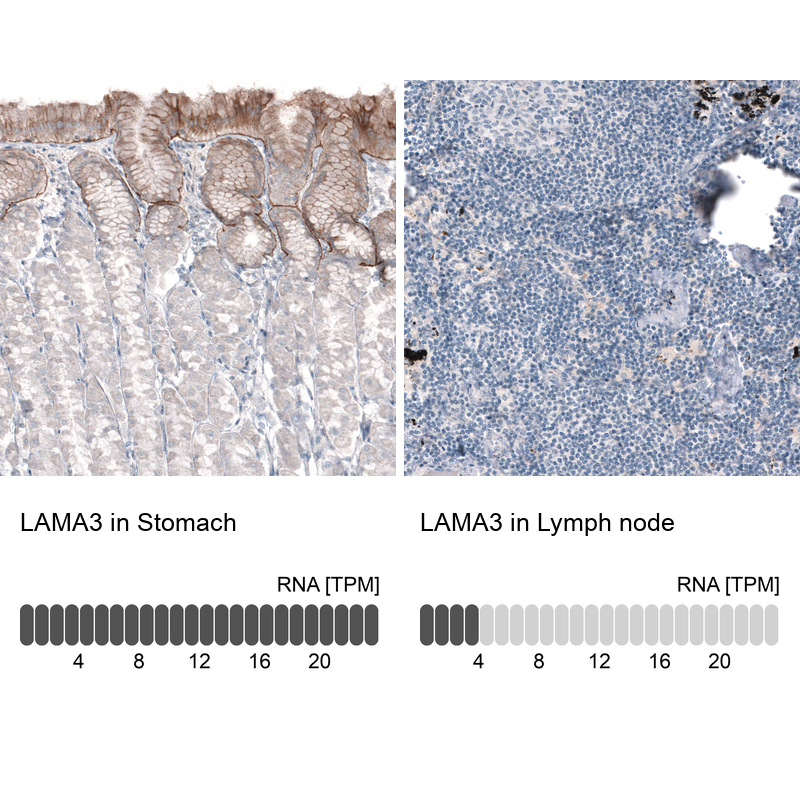 Anti-LAMA3 Antibody