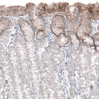 Immunohistochemical staining of human stomach shows moderate positivity in basement membrane of glandular cells.