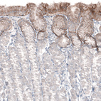 Anti-LAMA3 Antibody