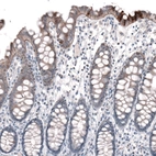 Immunohistochemical staining of human colon shows moderate positivity in basement membrane of glandular cells.