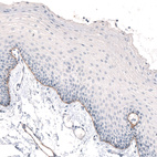 Immunohistochemical staining of human oral mucosa shows moderate positivity in basement membrane of squamous epithelial cells.