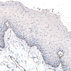 Immunohistochemical staining of human oral mucosa shows moderate positivity in basement membrane of squamous epithelial cells.