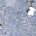 Immunohistochemical staining of human lymph node shows no positivity in lymphoid cells as expected.