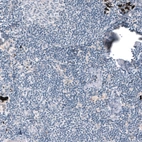 Immunohistochemical staining of human lymph node shows no positivity in lymphoid cells as expected.