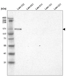 Western blot analysis of purified human recombinant Laminin-332, Laminin-421, Laminin-511, Laminin-121 and Laminin-221.
