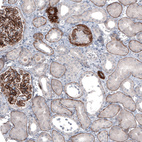 Immunohistochemical staining of human kidney shows strong membranous positivity in glomeruli, as well as in basement membrane of renal tubules.