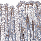 Anti-LAMA5 Antibody