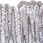 Immunohistochemical staining of human colon shows moderate positivity in basement membrane of glandular cells.