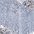 Immunohistochemical staining of human lymph node shows no positivity in lymphoid cells as expected.