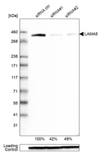 Western blot analysis in Caco-2 cells transfected with control siRNA, target specific siRNA probe #1 and #2, using Anti-LAMA5 antibody. Remaining relative intensity is presented. Loading control: Anti-GAPDH.