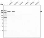 Western blot analysis of purified human recombinant Laminin-511, Laminin-521, Laminin-121, Laminin-221, Laminin-332 and Laminin-411.