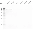 Western blot analysis of purified human recombinant Laminin-511, Laminin-521, Laminin-121, Laminin-221, Laminin-332 and Laminin-411.