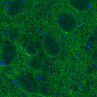 Anti-SLC6A3 Antibody