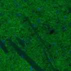 Immunofluorescence staining of mouse caudate putamen shows moderate positivity in dopaminergic fibers.