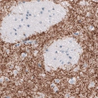 Immunohistochemical staining of human caudate nucleus shows strong positivity in dopaminergic fibers.