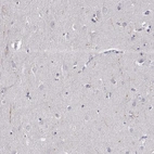 Immunohistochemical staining of human cerebral cortex shows weak positivity in a subset of neuronal processes.